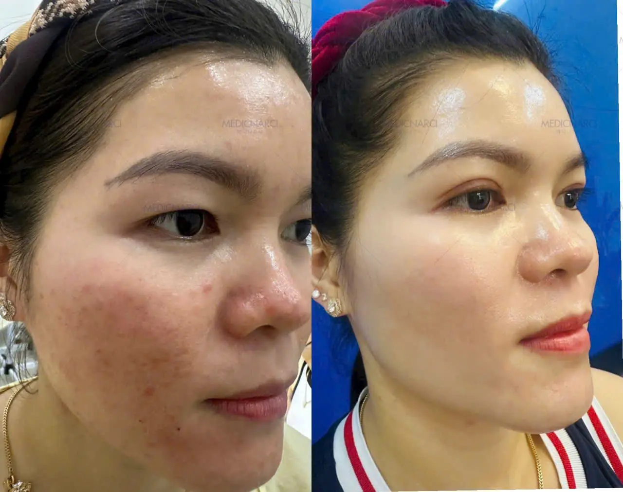 Danh mục album